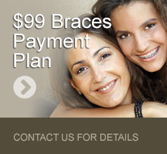 sidebar-99-braces-payment-plan